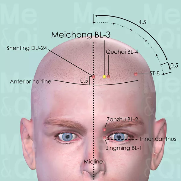 Meichong BL-3 - Skin view - Acupuncture point on Bladder Channel
