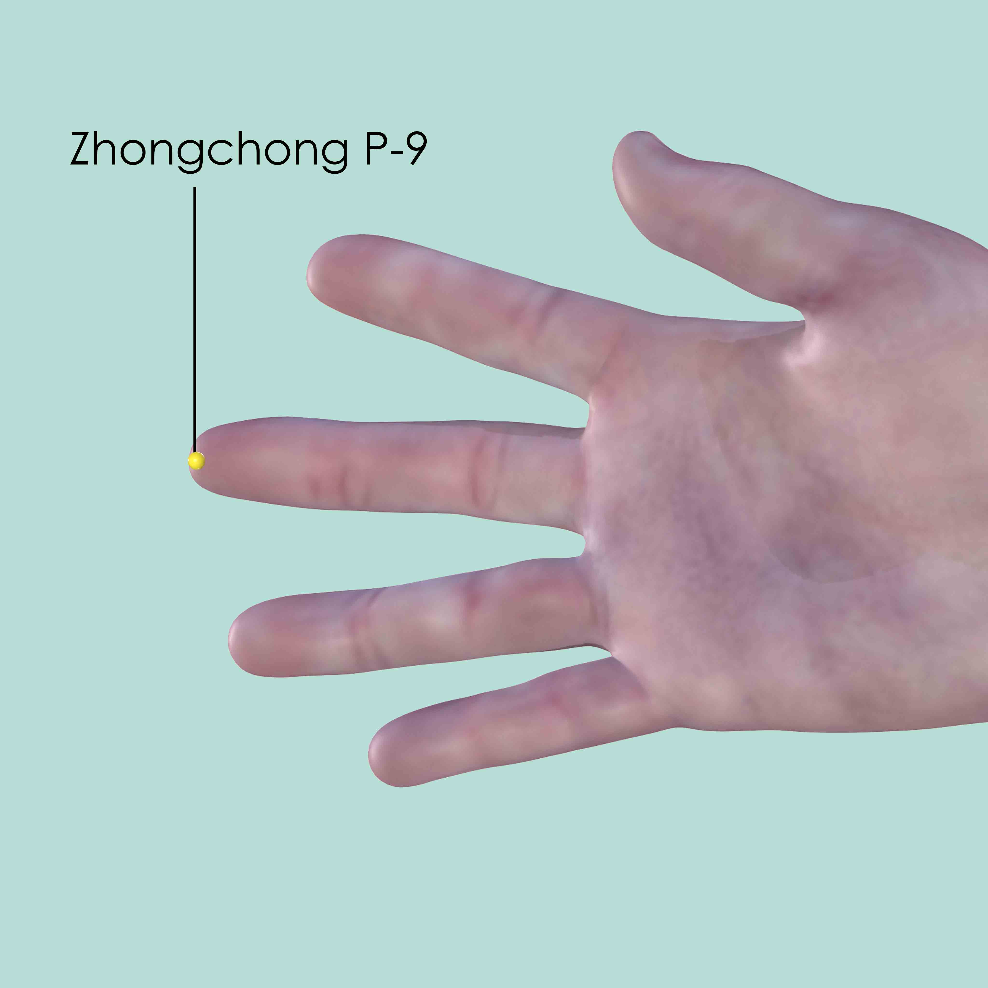 Zhongchong P-9