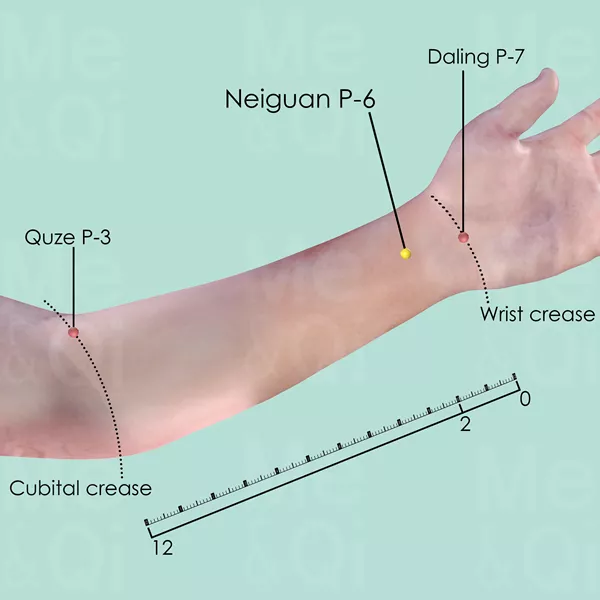Neiguan P-6 - Skin view - Acupuncture point on Pericardium Channel