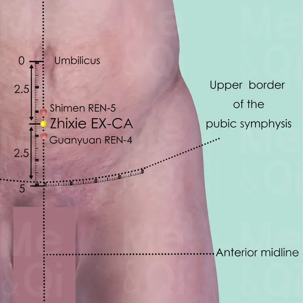 Zhixie EX-CA location