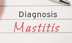 What are the first signs of mastitis?