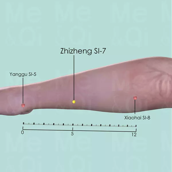 Zhizheng SI-7 - Skin view - Acupuncture point on Small Intestine Channel