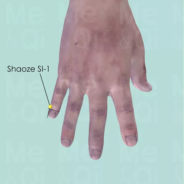 Shaoze SI-1 - Skin view - Acupuncture point on Small Intestine Channel