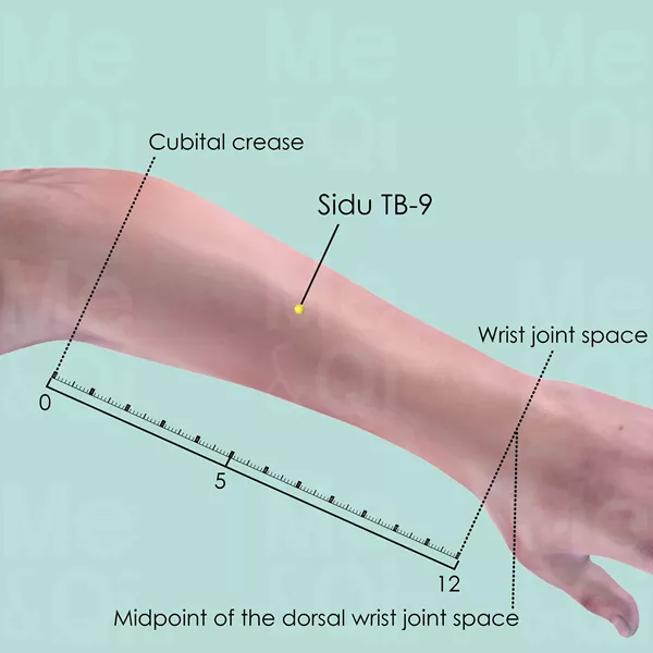 Sidu TB-9 - Skin view - Acupuncture point on Triple Burner Channel