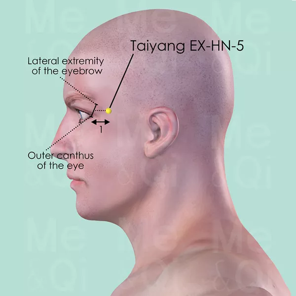 Taiyang EX-HN-5 - Skin view - Acupuncture point on Extra Points: Head and Neck (EX-HN)