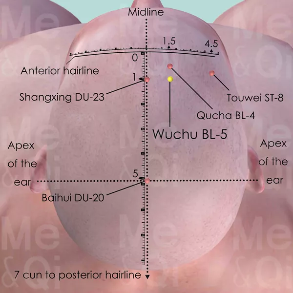 Wuchu BL-5 - Skin view - Acupuncture point on Bladder Channel