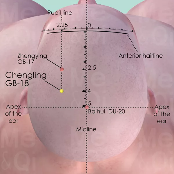 Chengling  GB-18 - Skin view - Acupuncture point on Gall Bladder Channel