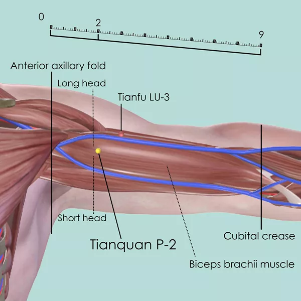 Tianquan P-2 - Muscles view - Acupuncture point on Pericardium Channel