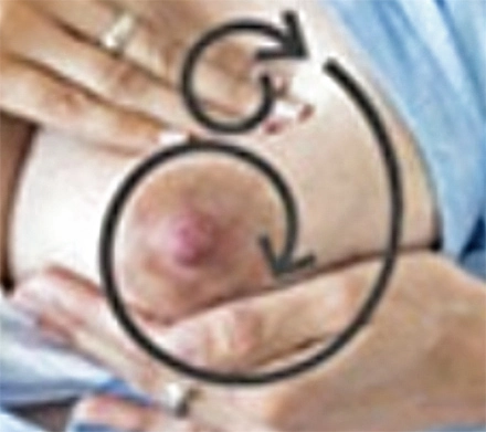 Breast massage against clogged milk ducts step 2 bis