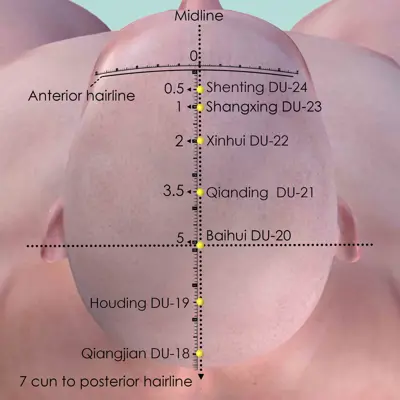 Governing  Vessel Primary pathway pathway