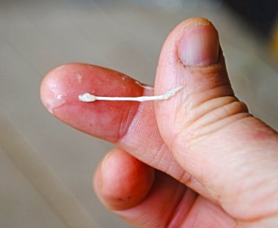 Clogged Milk Duct Coming Out