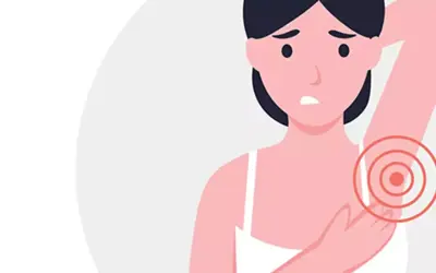 Mastitis And Clogged Duct In Armpit