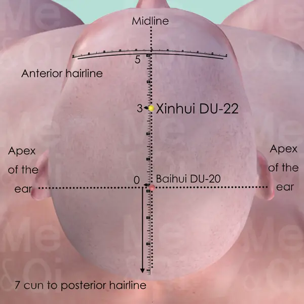 Xinhui DU-22 location
