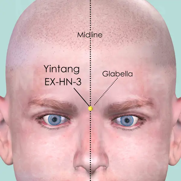 Yintang EX-HN-3 location