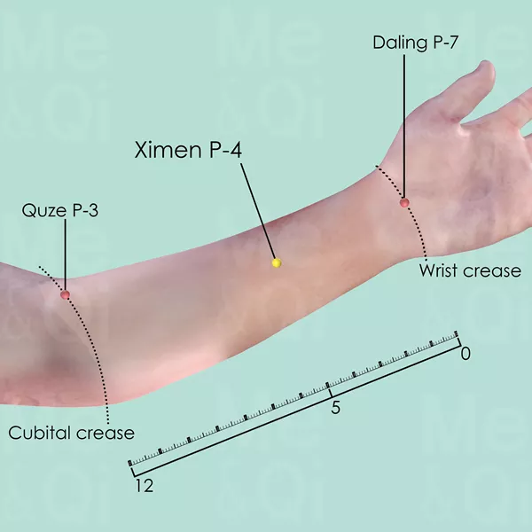 Ximen P-4 - Skin view - Acupuncture point on Pericardium Channel