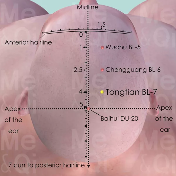 Tongtian BL-7 - Skin view - Acupuncture point on Bladder Channel