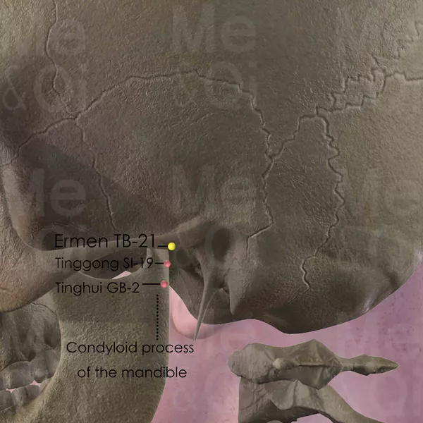Ermen TB-21 - Bones view - Acupuncture point on Triple Burner Channel