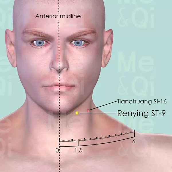 Renying ST-9 - Skin view - Acupuncture point on Stomach Channel