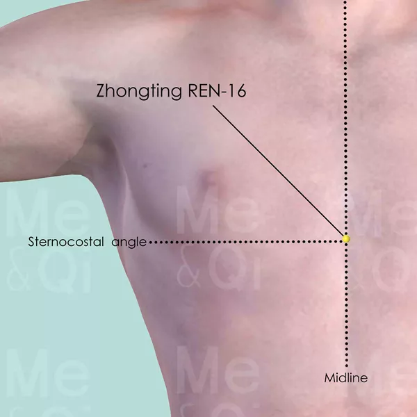 Zhongting REN-16 - Skin view - Acupuncture point on Directing Vessel