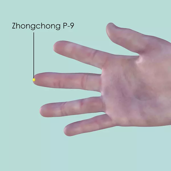 Zhongchong P-9 - Skin view - Acupuncture point on Pericardium Channel