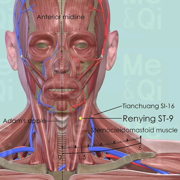 Renying ST-9 - Muscles view - Acupuncture point on Stomach Channel