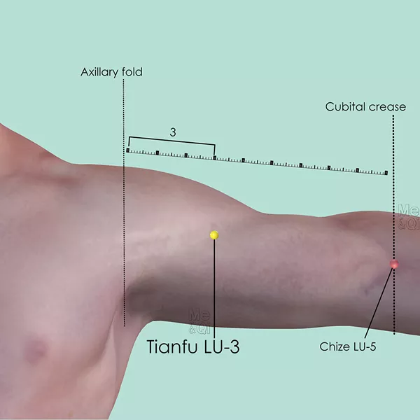 Tianfu LU-3 - Skin view - Acupuncture point on Lung Channel