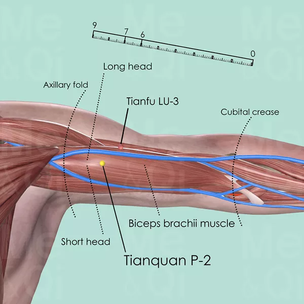 Tianquan P-2 - Skin view - Acupuncture point on Pericardium Channel