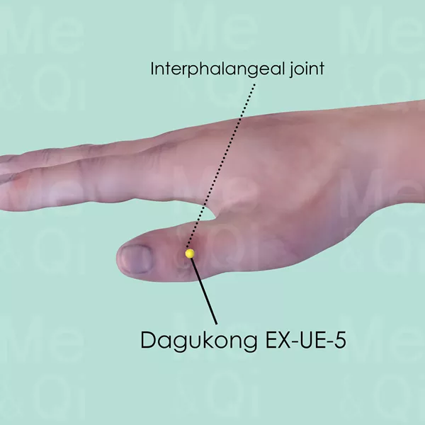 Dagukong EX-UE-5 - Skin view - Acupuncture point on Extra Points: Upper Extremities (EX-UE)