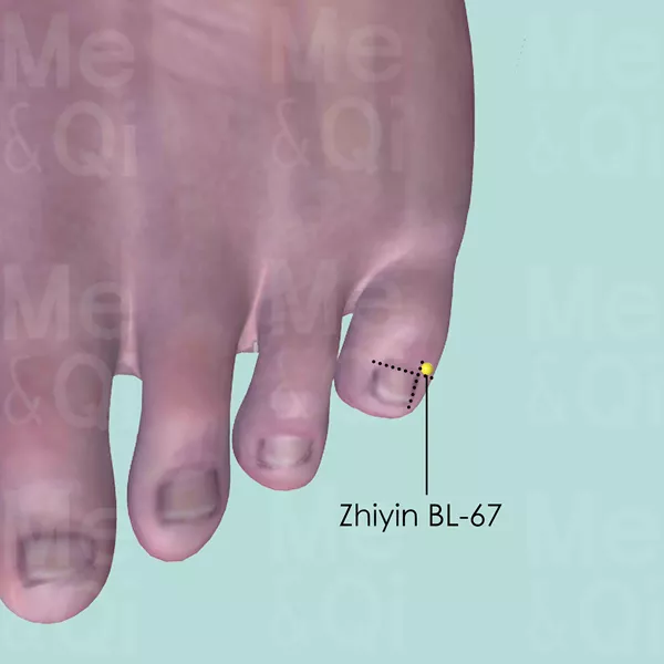 Zhiyin BL-67 - Skin view - Acupuncture point on Bladder Channel