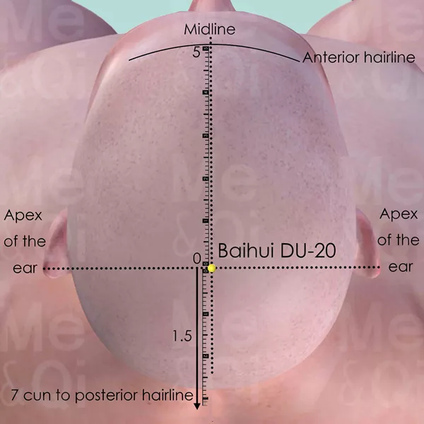 Baihui DU-20 - Skin view - Acupuncture point on Governing Vessel