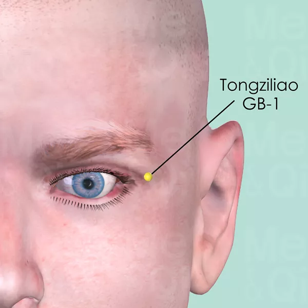 Tongziliao GB-1 - Skin view - Acupuncture point on Gall Bladder Channel