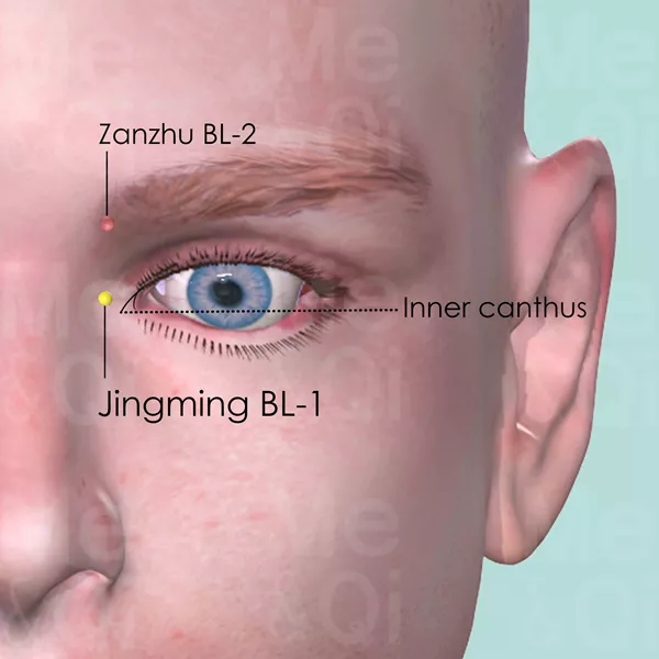 Jingming BL-1 - Skin view - Acupuncture point on Bladder Channel