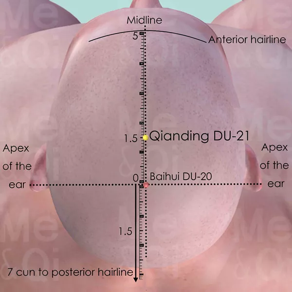 Qianding DU-21 - Skin view - Acupuncture point on Governing Vessel
