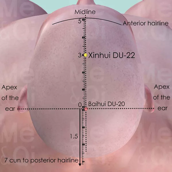 Xinhui DU-22 - Skin view - Acupuncture point on Governing Vessel
