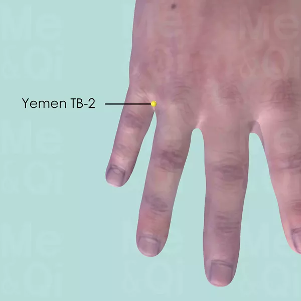 Yemen TB-2 - Skin view - Acupuncture point on Triple Burner Channel