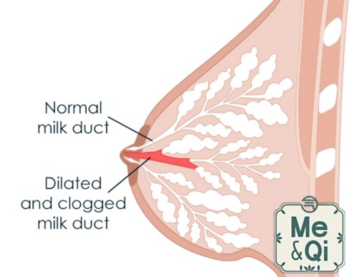 Anatomy Clogged Milk Duct