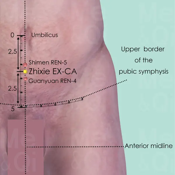 Zhixie EX-CA location