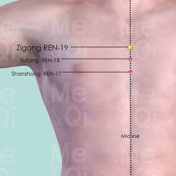 Zigong REN-19 - Skin view - Acupuncture point on Directing Vessel