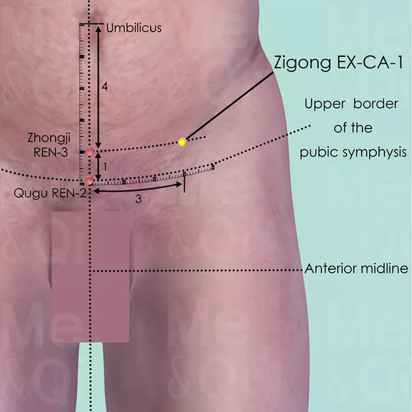 Zigong EX-CA-1 - Skin view - Acupuncture point on Extra Points: Chest and Abdomen (EX-CA)