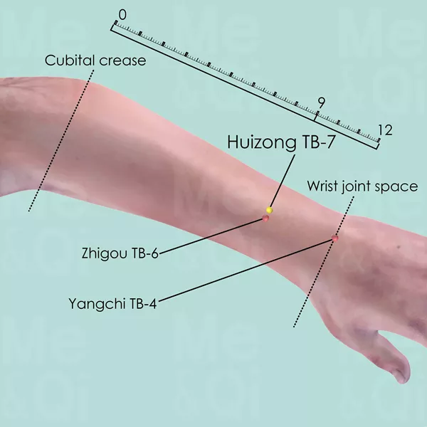 Huizong ST-7 - Skin view - Acupuncture point on Triple Burner Channel