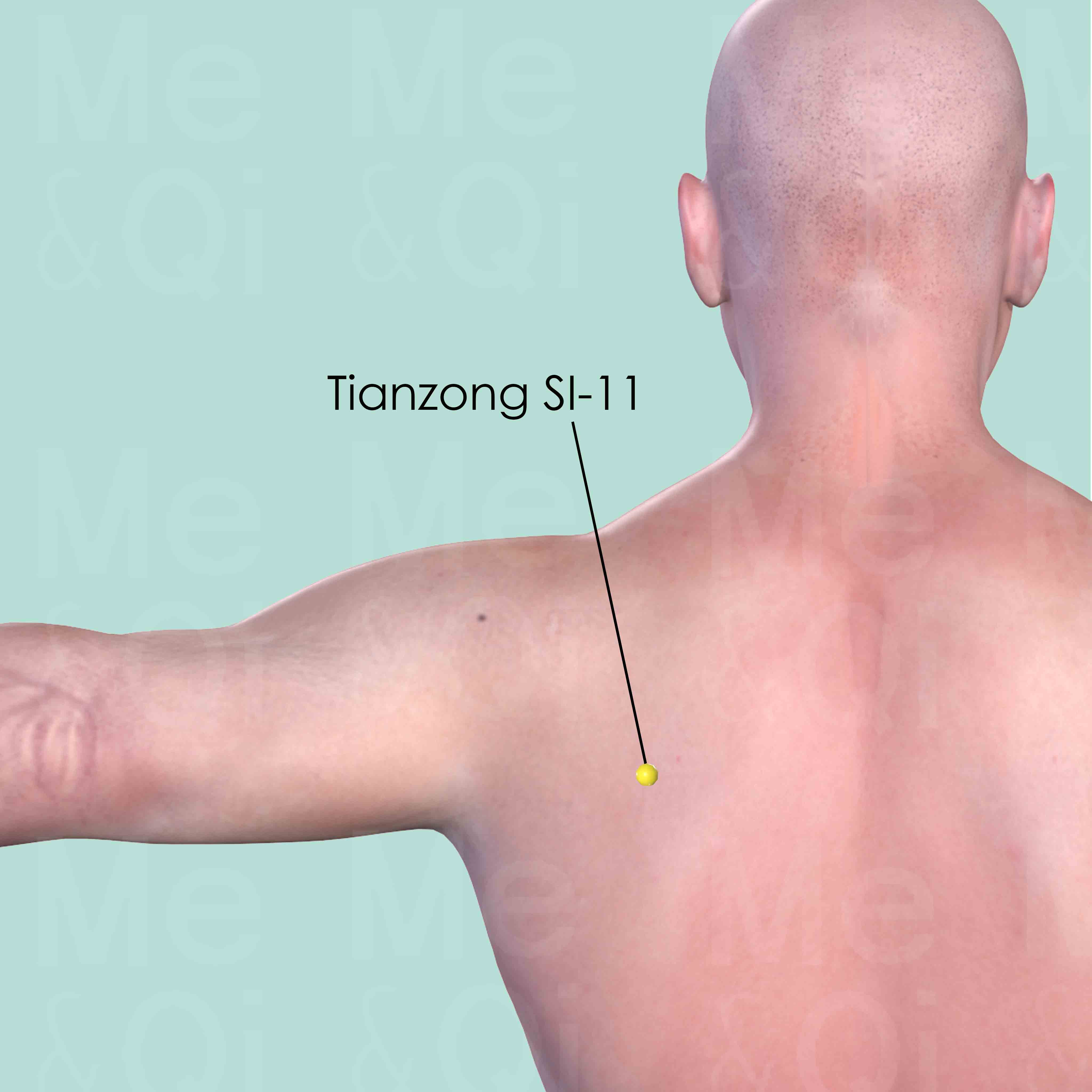 Tianzong SI-11