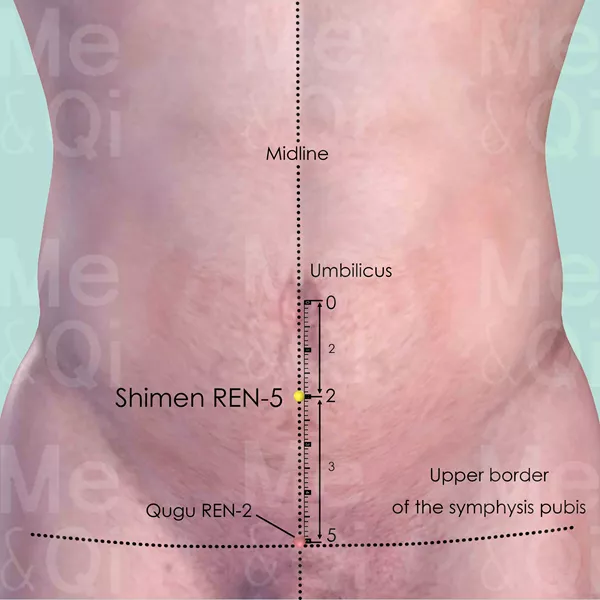 Shimen REN-5 - Skin view - Acupuncture point on Directing Vessel