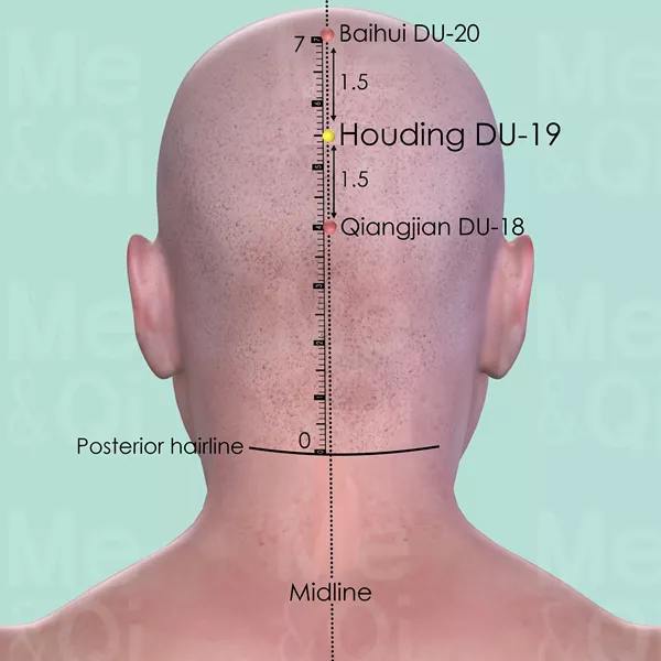 Houding DU-19 - Skin view - Acupuncture point on Governing Vessel