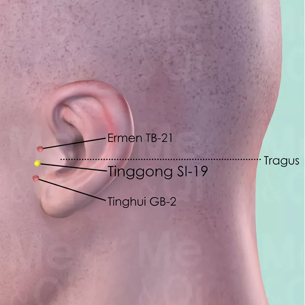 Tinggong SI-19 - Skin view - Acupuncture point on Small Intestine Channel