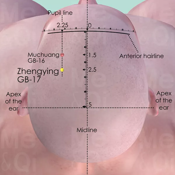 Zhengying GB-17 - Skin view - Acupuncture point on Gall Bladder Channel