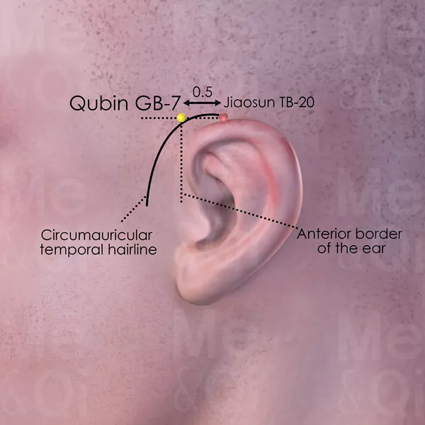 Qubin GB-7 - Skin view - Acupuncture point on Gall Bladder Channel