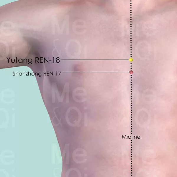 Yutang REN-18 - Skin view - Acupuncture point on Directing Vessel