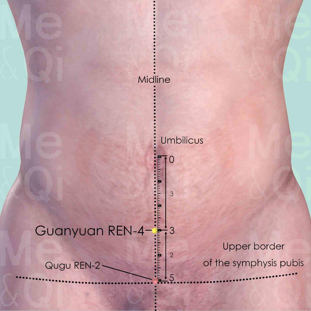 Guanyuan REN-4 location