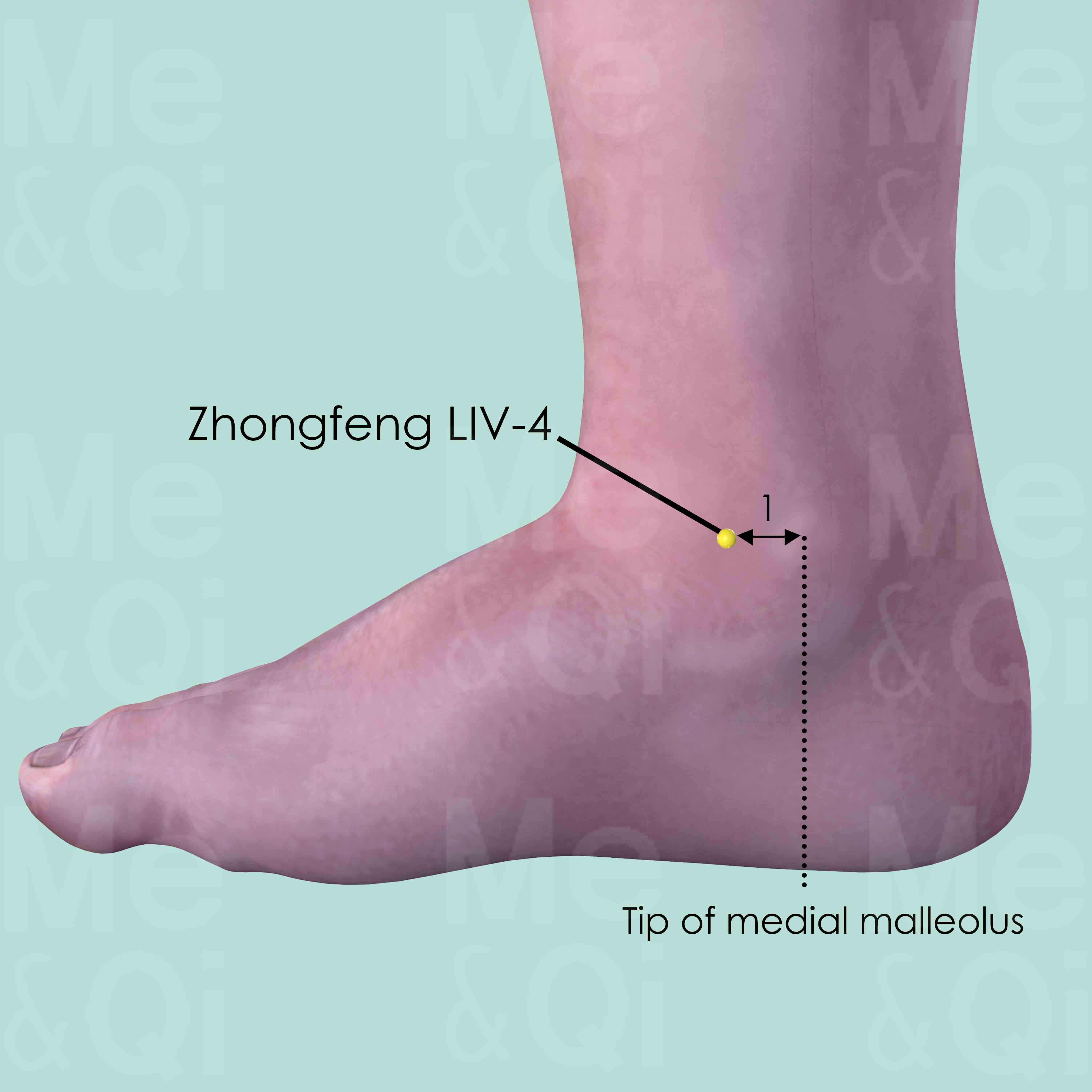Zhongfeng LIV-4