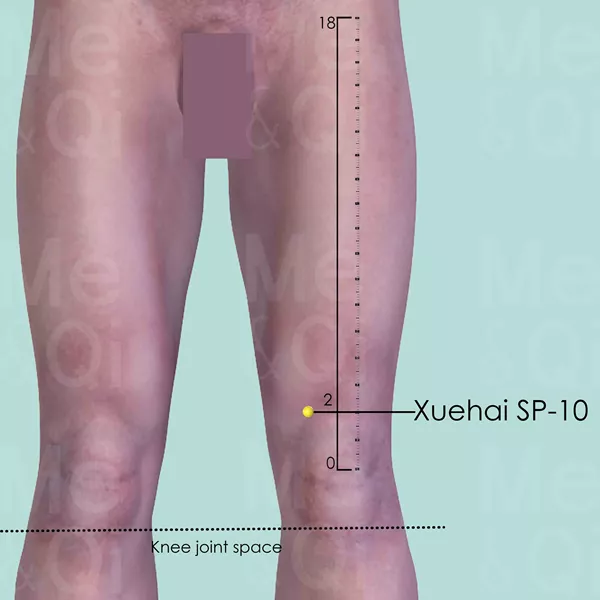 Xuehai SP-10 - Skin view - Acupuncture point on Spleen Channel